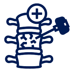 Vertebroplasty And Kyphoplasty